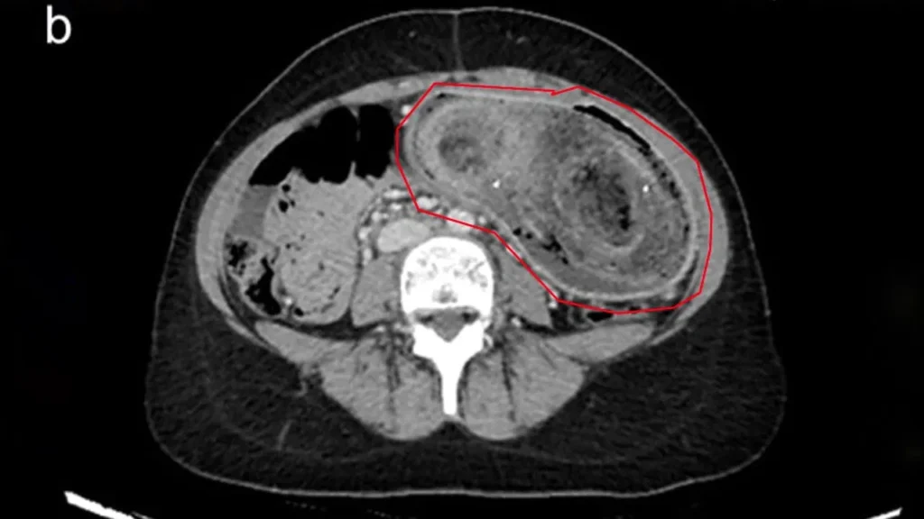 representative-image-23